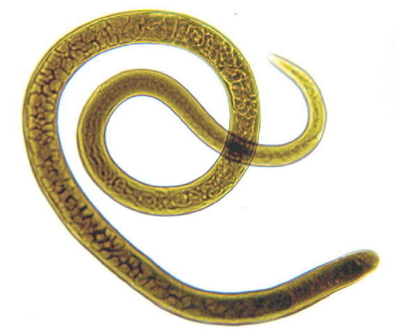 Trichinella spiralis фото